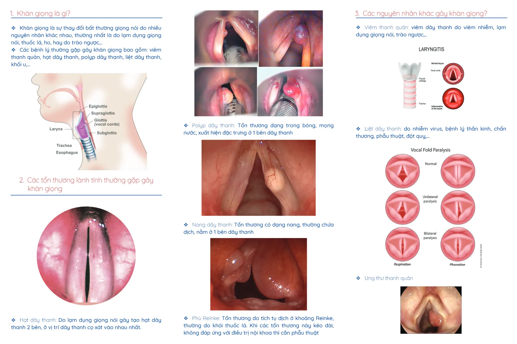 to roi khan giong va nhung dieu can biet_2.webp